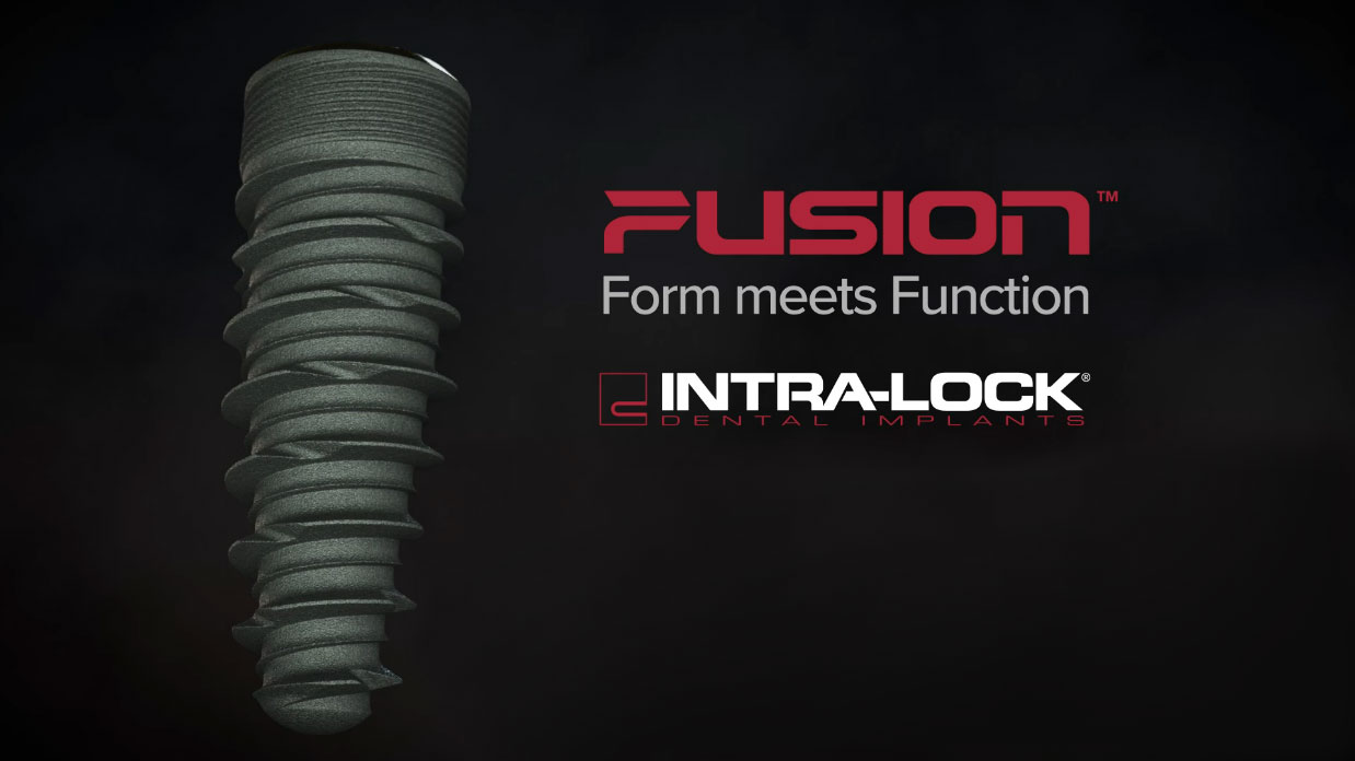 Fusion Dental Implants