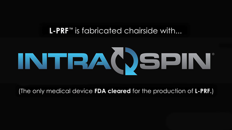 IntraSpin / L-PRF Step-By-Step Overview