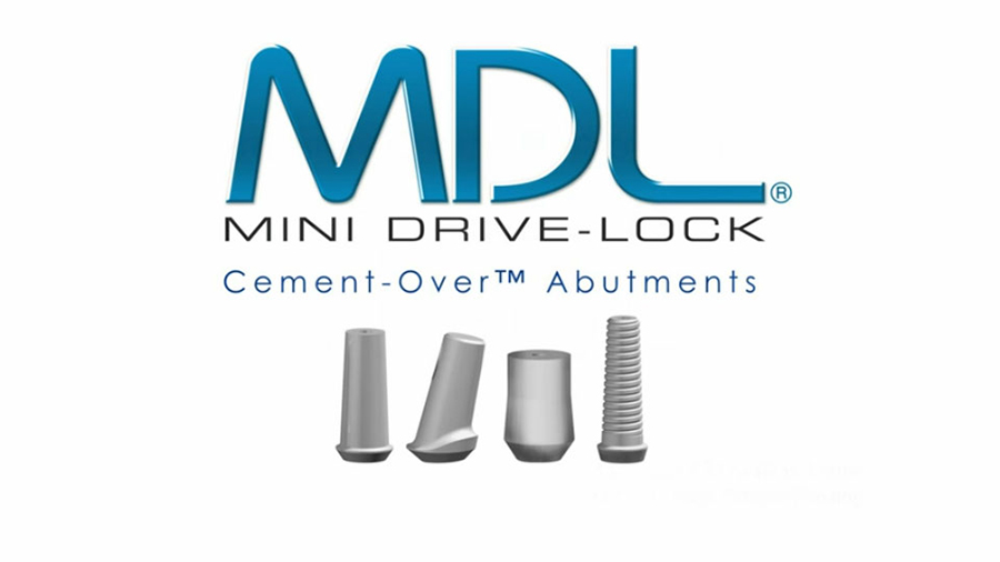 MDL Cement-Over Titanium Abutment System