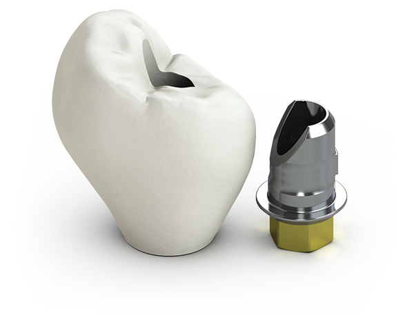 Vulcan custom abutments